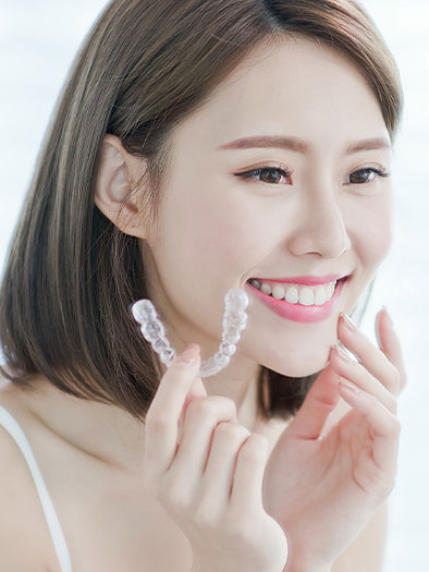 clear aligners